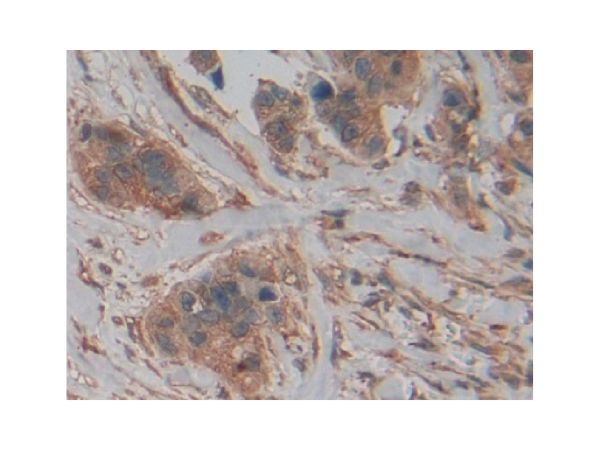 aladdin 阿拉丁 Ab122143 PKM Antibody pAb; Rabbit anti Human PKM Antibody; WB, IHC, ICC, IF; Unconjugated