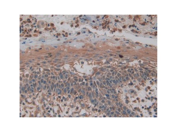 aladdin 阿拉丁 Ab122143 PKM Antibody pAb; Rabbit anti Human PKM Antibody; WB, IHC, ICC, IF; Unconjugated