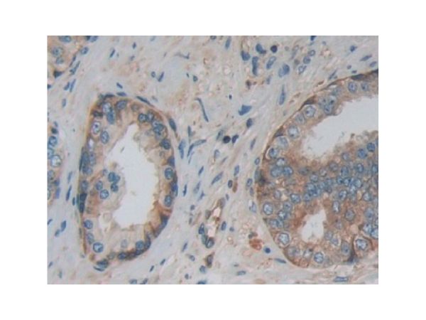 aladdin 阿拉丁 Ab122143 PKM Antibody pAb; Rabbit anti Human PKM Antibody; WB, IHC, ICC, IF; Unconjugated