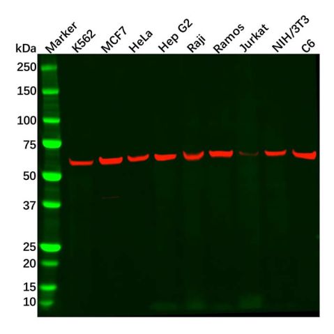 aladdin 阿拉丁 Ab122149 PKM2 Antibody pAb; Rabbit anti Human PKM2 Antibody; WB, IHC, IF/ICC; Unconjugated