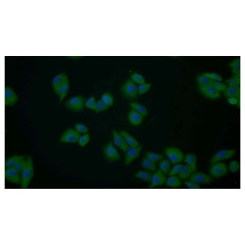 aladdin 阿拉丁 Ab122149 PKM2 Antibody pAb; Rabbit anti Human PKM2 Antibody; WB, IHC, IF/ICC; Unconjugated