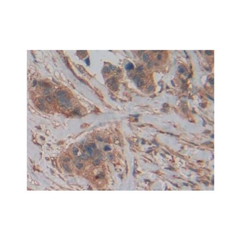 aladdin 阿拉丁 Ab122149 PKM2 Antibody pAb; Rabbit anti Human PKM2 Antibody; WB, IHC, IF/ICC; Unconjugated