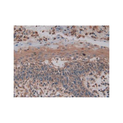 aladdin 阿拉丁 Ab122149 PKM2 Antibody pAb; Rabbit anti Human PKM2 Antibody; WB, IHC, IF/ICC; Unconjugated