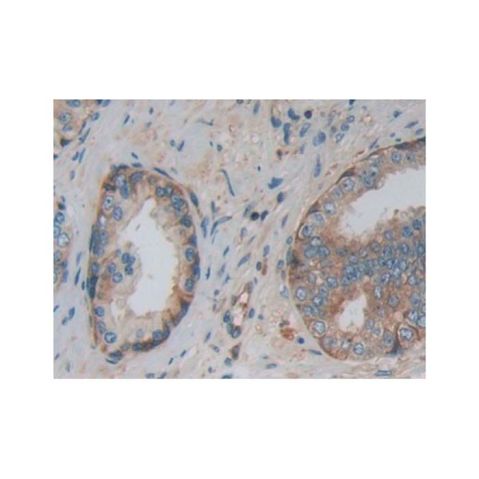 aladdin 阿拉丁 Ab122149 PKM2 Antibody pAb; Rabbit anti Human PKM2 Antibody; WB, IHC, IF/ICC; Unconjugated