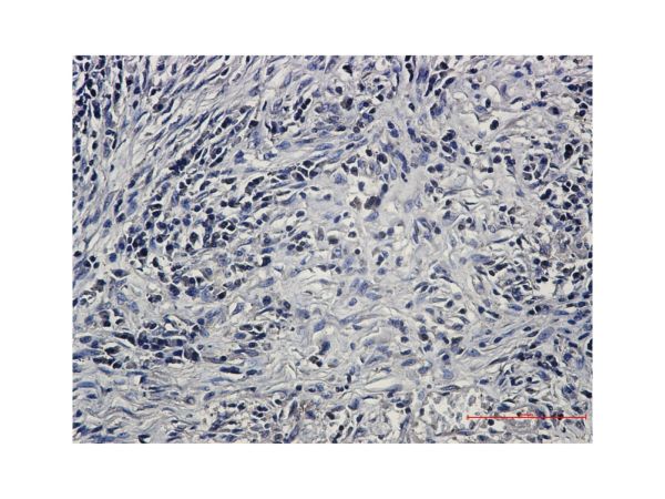 aladdin 阿拉丁 Ab122709 Recombinant PP2A alpha/beta Antibody Recombinant (R04-4G4); Rabbit anti Human PP2A alpha/beta Antibody; WB, IHC, ICC, IF; Unconjugated