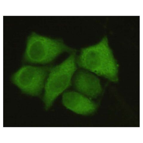aladdin 阿拉丁 Ab122816 PPP1A/PPP1CA Mouse mAb mAb (1H1-F7-D8); Mouse anti Human PPP1A/PPP1CA Antibody; WB, ICC, IF; Unconjugated
