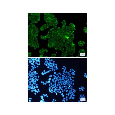 aladdin 阿拉丁 Ab122822 Recombinant PPP1CB Antibody Recombinant (R09-6B7); Rabbit anti Human PPP1CB Antibody; WB, IHC, ICC, IF; Unconjugated