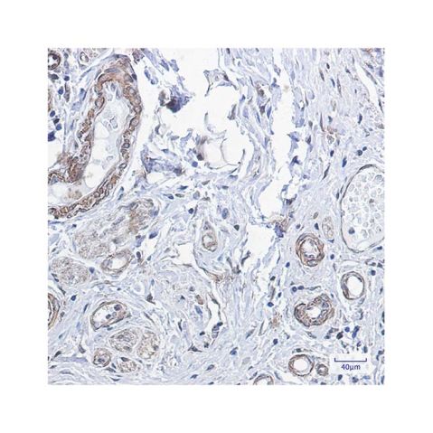 aladdin 阿拉丁 Ab122822 Recombinant PPP1CB Antibody Recombinant (R09-6B7); Rabbit anti Human PPP1CB Antibody; WB, IHC, ICC, IF; Unconjugated