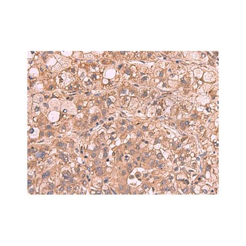 aladdin 阿拉丁 Ab122840 PPP2R1A Antibody pAb; Rabbit anti Human PPP2R1A Antibody; WB, IHC; Unconjugated