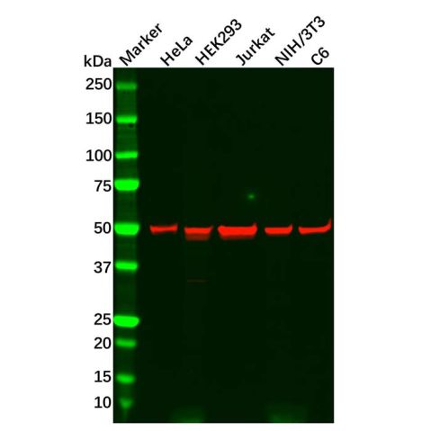 aladdin 阿拉丁 Ab122877 Recombinant PPP2R5E Antibody Recombinant (R06-6E2); Rabbit anti Human PPP2R5E Antibody; WB; Unconjugated