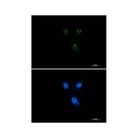 aladdin 阿拉丁 Ab123023 Recombinant Presenilin 1/PS-1 Antibody Recombinant (R05-4D4); Rabbit anti Human Presenilin 1/PS-1 Antibody; WB, IF, ICC; Unconjugated