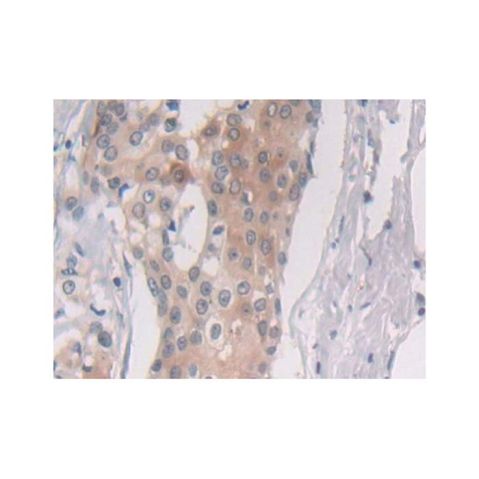 aladdin 阿拉丁 Ab123385 Proteasome 20S beta 6 Antibody pAb; Rabbit anti Human Proteasome 20S beta 6 Antibody; WB, IHC; Unconjugated