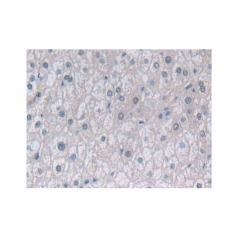 aladdin 阿拉丁 Ab123385 Proteasome 20S beta 6 Antibody pAb; Rabbit anti Human Proteasome 20S beta 6 Antibody; WB, IHC; Unconjugated