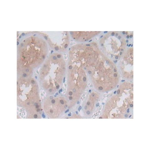 aladdin 阿拉丁 Ab123385 Proteasome 20S beta 6 Antibody pAb; Rabbit anti Human Proteasome 20S beta 6 Antibody; WB, IHC; Unconjugated