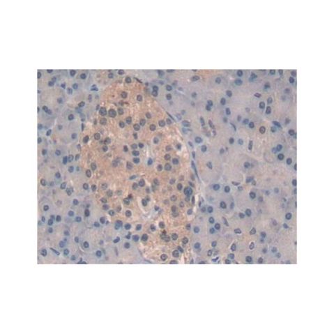 aladdin 阿拉丁 Ab123385 Proteasome 20S beta 6 Antibody pAb; Rabbit anti Human Proteasome 20S beta 6 Antibody; WB, IHC; Unconjugated