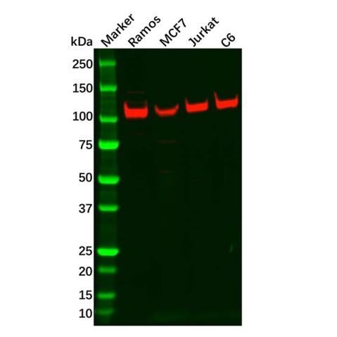 aladdin 阿拉丁 Ab123578 Recombinant PSD93 Antibody Recombinant (R02-4E7); Rabbit anti Human PSD93 Antibody; WB; Unconjugated