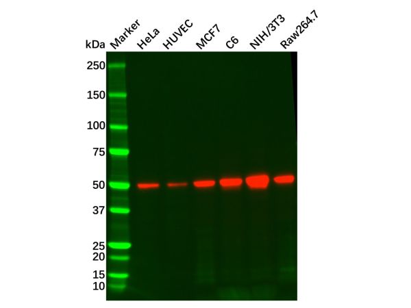 aladdin 阿拉丁 Ab123795 PTEN Mouse mAb mAb(C3); Mouse anti Human PTEN Antibody; WB, IHC; Unconjugated