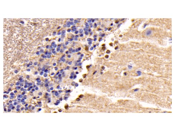 aladdin 阿拉丁 Ab123795 PTEN Mouse mAb mAb(C3); Mouse anti Human PTEN Antibody; WB, IHC; Unconjugated