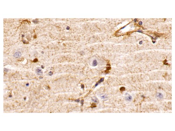 aladdin 阿拉丁 Ab123795 PTEN Mouse mAb mAb(C3); Mouse anti Human PTEN Antibody; WB, IHC; Unconjugated