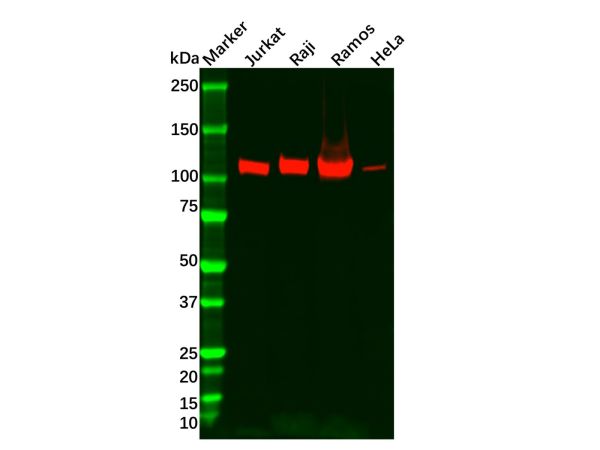 aladdin 阿拉丁 Ab124023 Recombinant PYK2 Antibody Recombinant (R05-5E6); Rabbit anti Human PTK2B Antibody; WB, IHC; Unconjugated