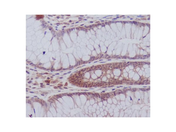 aladdin 阿拉丁 Ab124023 Recombinant PYK2 Antibody Recombinant (R05-5E6); Rabbit anti Human PTK2B Antibody; WB, IHC; Unconjugated