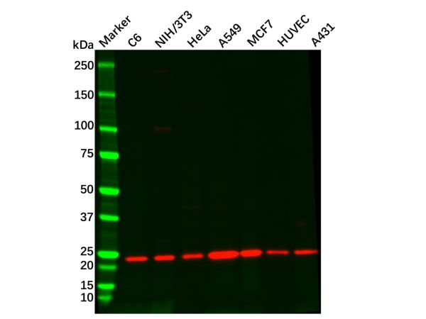 aladdin 阿拉丁 Ab124097 Recombinant RAB10 Antibody Recombinant (R06-2A3); Rabbit anti Human RAB10 Antibody; WB, ICC, IF; Unconjugated