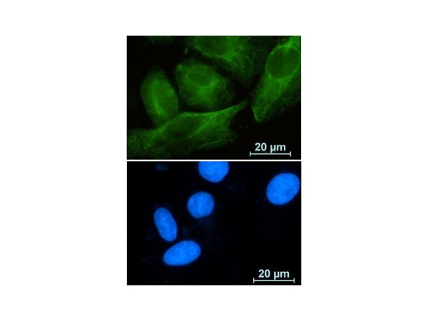 aladdin 阿拉丁 Ab124097 Recombinant RAB10 Antibody Recombinant (R06-2A3); Rabbit anti Human RAB10 Antibody; WB, ICC, IF; Unconjugated