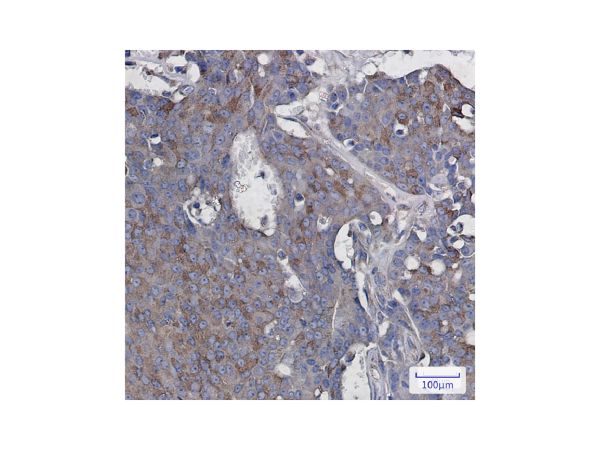 aladdin 阿拉丁 Ab124318 Recombinant Rac3 Antibody Recombinant (R01-6I8); Rabbit anti Human Rac3 Antibody; WB, IHC; Unconjugated