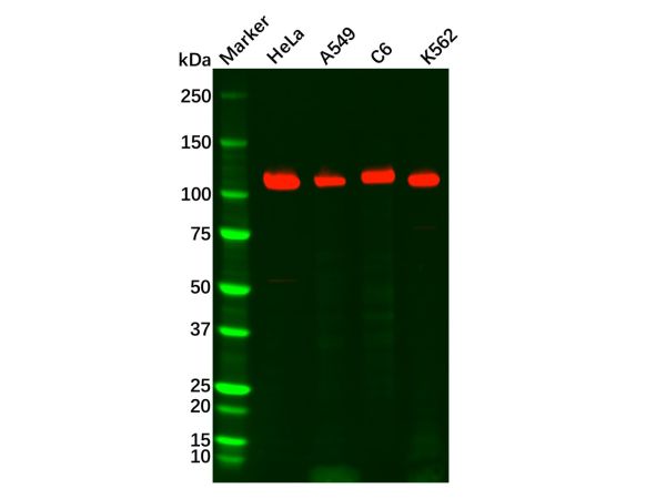 aladdin 阿拉丁 Ab124351 Recombinant Rad21 Antibody Recombinant (R03-5I0); Rabbit anti Human Rad21 Antibody; WB, IHC, ICC, IF; Unconjugated