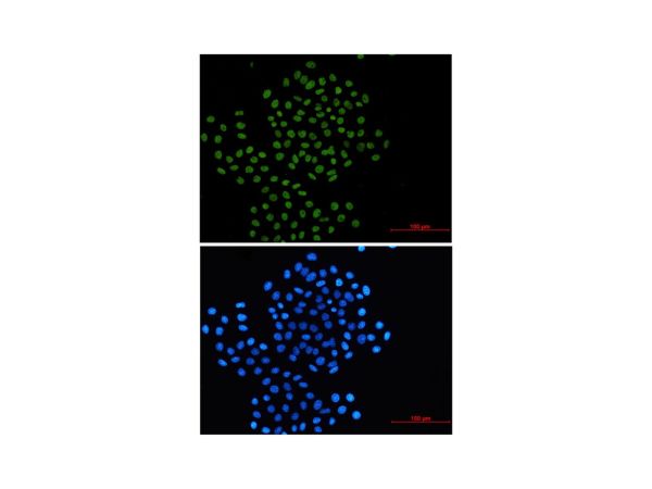 aladdin 阿拉丁 Ab124351 Recombinant Rad21 Antibody Recombinant (R03-5I0); Rabbit anti Human Rad21 Antibody; WB, IHC, ICC, IF; Unconjugated