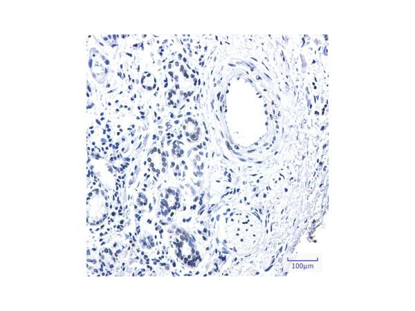 aladdin 阿拉丁 Ab124351 Recombinant Rad21 Antibody Recombinant (R03-5I0); Rabbit anti Human Rad21 Antibody; WB, IHC, ICC, IF; Unconjugated