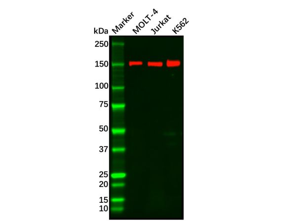 aladdin 阿拉丁 Ab124364 Recombinant Rad50 Antibody Recombinant (R07-8C0); Rabbit anti Human Rad50 Antibody; WB, IHC; Unconjugated