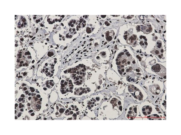 aladdin 阿拉丁 Ab124364 Recombinant Rad50 Antibody Recombinant (R07-8C0); Rabbit anti Human Rad50 Antibody; WB, IHC; Unconjugated
