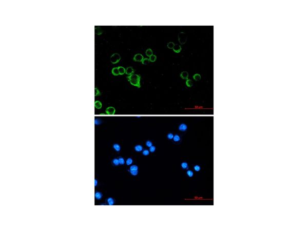 aladdin 阿拉丁 Ab124431 Recombinant Raf1 Antibody Recombinant (R05-9B1); Rabbit anti Human Raf1 Antibody; WB, ICC, IF; Unconjugated
