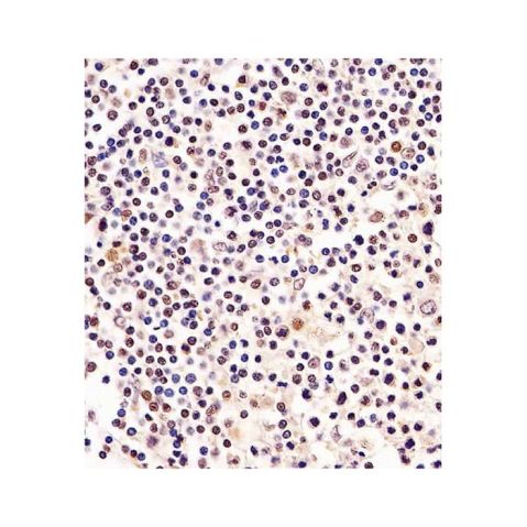 aladdin 阿拉丁 Ab125728 RPA32/RPA2 Mouse mAb mAb (1591CT183.68.6); Mouse anti Human RPA32/RPA2 Antibody; WB, IHC; Unconjugated