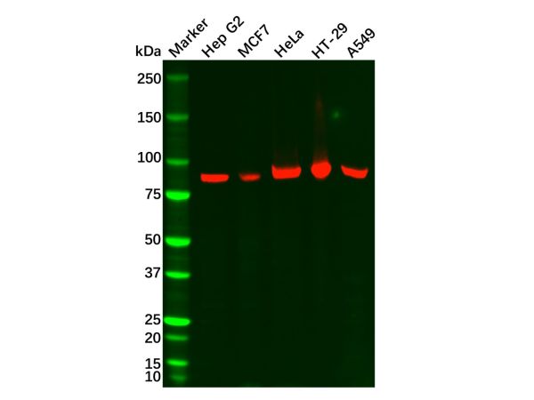 aladdin 阿拉丁 Ab126009 Recombinant RRM1 Antibody Recombinant (R08-4D3); Rabbit anti Human RRM1 Antibody; WB, IHC, ICC, IF; Unconjugated
