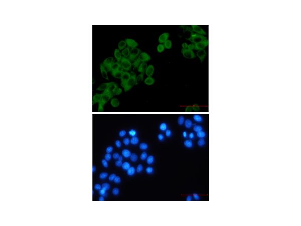 aladdin 阿拉丁 Ab126009 Recombinant RRM1 Antibody Recombinant (R08-4D3); Rabbit anti Human RRM1 Antibody; WB, IHC, ICC, IF; Unconjugated