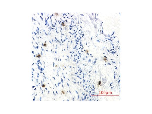 aladdin 阿拉丁 Ab126009 Recombinant RRM1 Antibody Recombinant (R08-4D3); Rabbit anti Human RRM1 Antibody; WB, IHC, ICC, IF; Unconjugated
