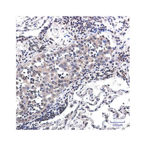 aladdin 阿拉丁 Ab126046 Recombinant RSK2 Antibody Recombinant (R05-6E3); Rabbit anti Human RSK2 Antibody; WB, IHC; Unconjugated