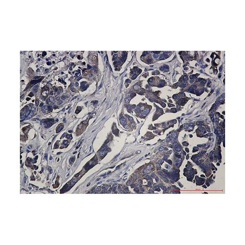 aladdin 阿拉丁 Ab126061 Recombinant RSK1 p90 Antibody Recombinant (R02-2D2); Rabbit anti Human RSK1 p90 Antibody; WB, IHC; Unconjugated