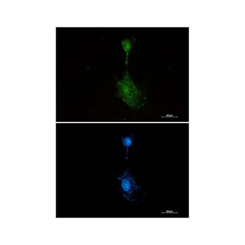 aladdin 阿拉丁 Ab126068 Recombinant RSK3 Antibody Recombinant (R05-5E4); Rabbit anti Human RSK3 Antibody; WB, IHC, ICC, IF; Unconjugated