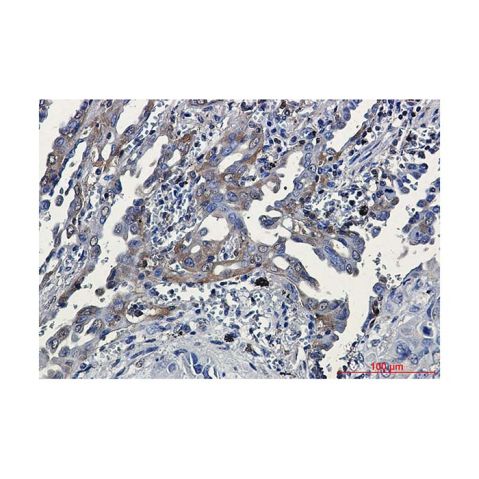 aladdin 阿拉丁 Ab126068 Recombinant RSK3 Antibody Recombinant (R05-5E4); Rabbit anti Human RSK3 Antibody; WB, IHC, ICC, IF; Unconjugated