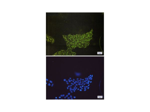 aladdin 阿拉丁 Ab126314 Recombinant S6K1 Antibody Recombinant (R01-4B5); Rabbit anti Human S6K1 Antibody; WB, ICC, IF; Unconjugated