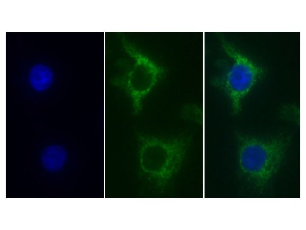 aladdin 阿拉丁 Ab126844 SDHA Mouse mAb mAb (C2); Mouse anti Human SDHA Antibody; WB, ICC, IF; Unconjugated