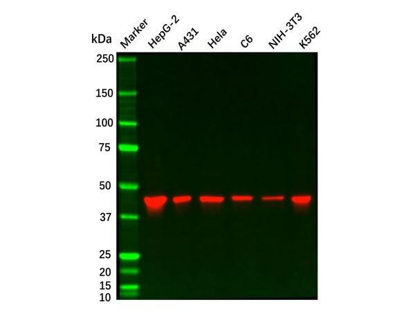 aladdin 阿拉丁 Ab126913 Recombinant SEC61A Antibody Recombinant (R07-6B6); Rabbit anti Human SEC61A Antibody; WB, IHC, ICC, IF; Unconjugated
