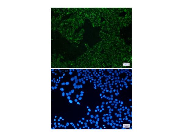 aladdin 阿拉丁 Ab126913 Recombinant SEC61A Antibody Recombinant (R07-6B6); Rabbit anti Human SEC61A Antibody; WB, IHC, ICC, IF; Unconjugated