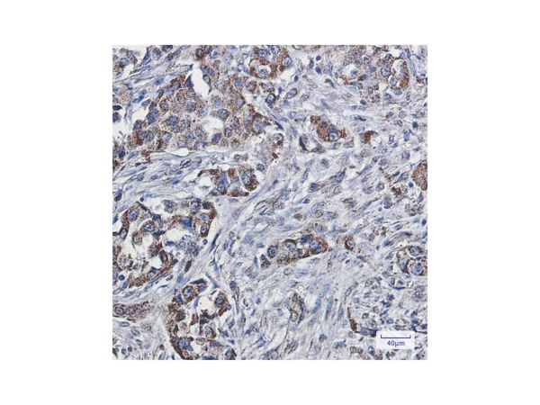 aladdin 阿拉丁 Ab126913 Recombinant SEC61A Antibody Recombinant (R07-6B6); Rabbit anti Human SEC61A Antibody; WB, IHC, ICC, IF; Unconjugated