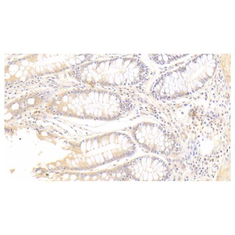 aladdin 阿拉丁 Ab127304 SFRP4 Mouse mAb mAb (5#); Mouse anti Human SFRP4 Antibody; WB,IHC; Unconjugated