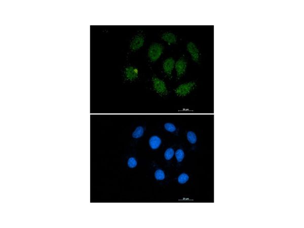 aladdin 阿拉丁 Ab128212 Recombinant SMAD3 Antibody Recombinant (R09-7H4); Rabbit anti Human SMAD3 Antibody; WB, IHC, ICC, IF; Unconjugated