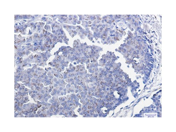 aladdin 阿拉丁 Ab128212 Recombinant SMAD3 Antibody Recombinant (R09-7H4); Rabbit anti Human SMAD3 Antibody; WB, IHC, ICC, IF; Unconjugated